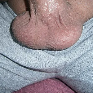 nice picseries 2 gallery image