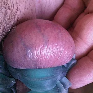 Ballgames gallery image