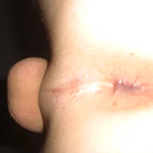 hole gallery image