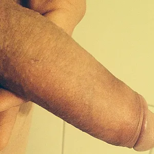 my best part gallery image
