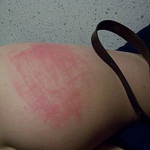 spanking gallery image