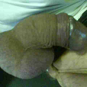 my bounded cock gallery image