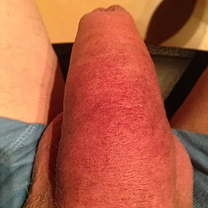 Meine Bilder Galeriebild