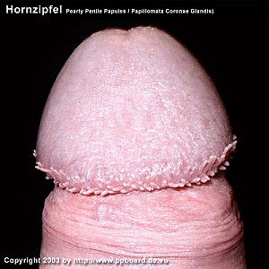 bumpy Profilbild