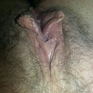 Hairy gallery image
