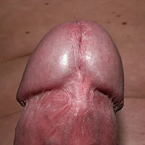 my cock with rrings gallery image