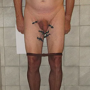 treatment gallery image