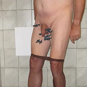 treatment gallery image