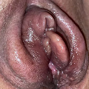 pumped gallery image