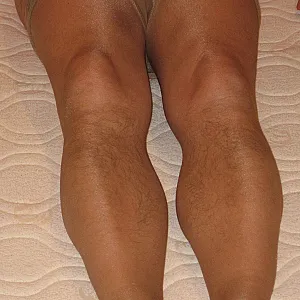 penetrated ass gallery image