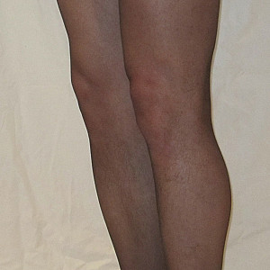 presented in a pantyhose gallery image