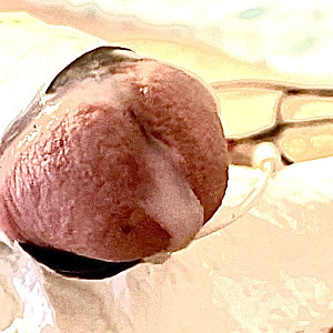 Dick gallery image