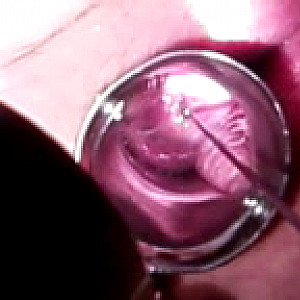 First Image Of dohlen's Video - Speculum