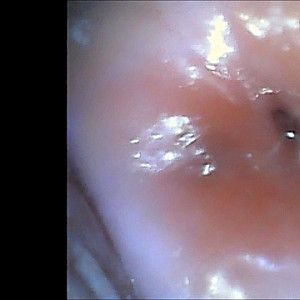 First Image Of Pipimaedchen's Video - Vagina internal