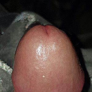 penis gallery image