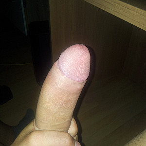 my dick gallery image