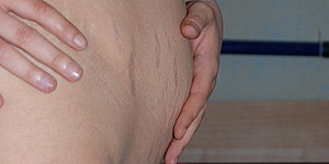 4. Monat schwanger First Thumb Image