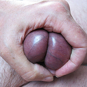 Tight balls Galeriebild