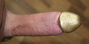goldene Eichel First Thumb Image