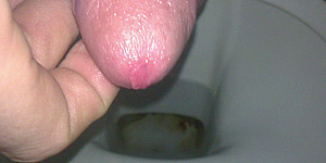 short pee First Thumb Image