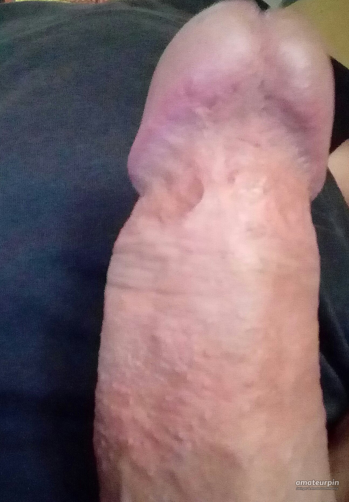 my cock gallery image