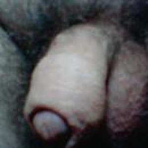 my dick gallery image