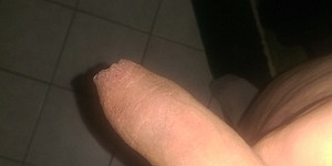 mein penis First Thumb Image