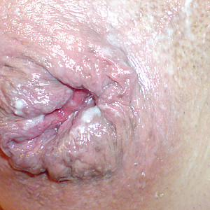 Anal 2013 gallery image