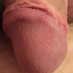 My small dick 2 gallery image