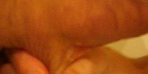 blasen und eier masage First Thumb Image