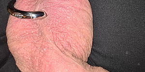 Transscrotal Piercing First Thumb Image
