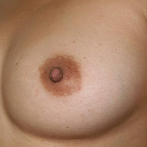 Nipples Galerie