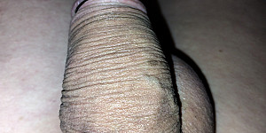 Eichelring  und Hodenring First Thumb Image