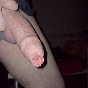 my dick gallery image