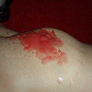 Hot candle wax on nipples gallery image