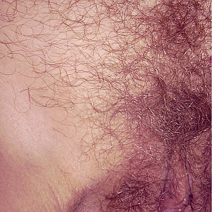 Hairy cunt Galerie