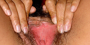 hairy gash First Thumb Image