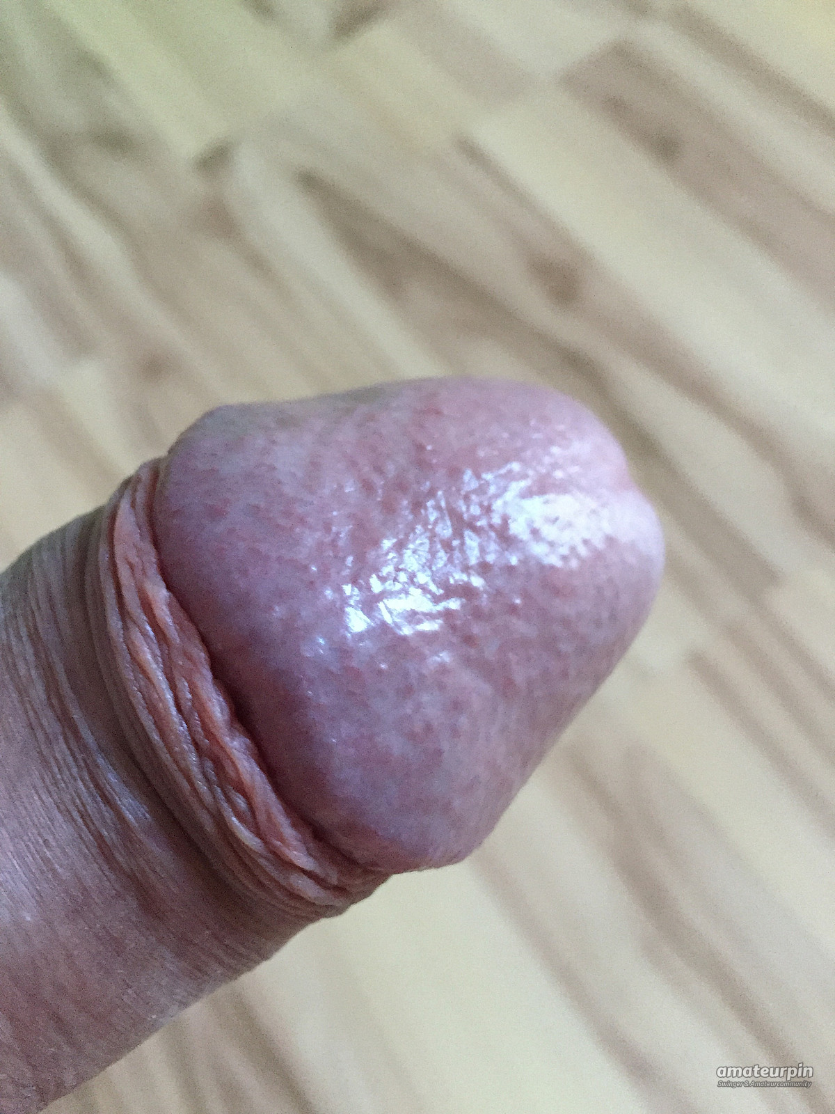 my penis gallery image