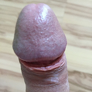 Mein Penis Galeriebild