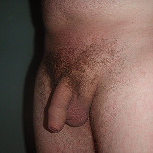 My hairy dick Galeriebild