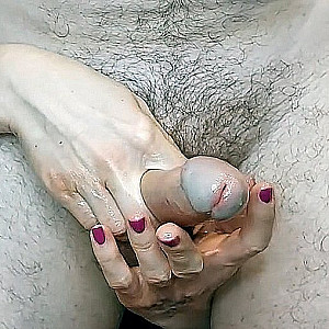 penis glans gallery image