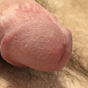 Hairy dick gallery image