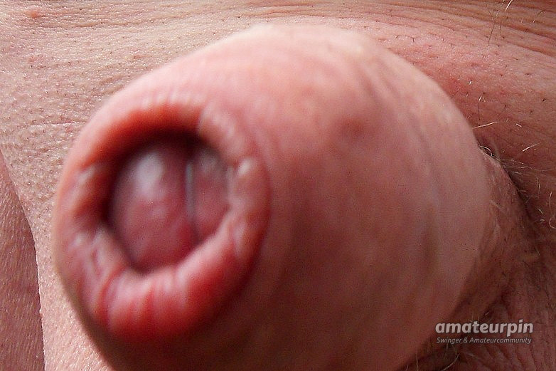 Penis modification gallery image