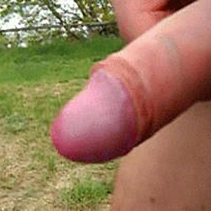 my dick gallery image