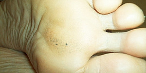 schmierkäse zwischen den zehen für den fußsklaven First Thumb Image