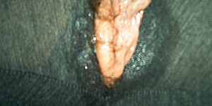 Loch in der Leggins First Thumb Image
