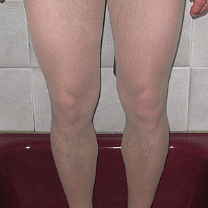 First image of pekki0965's Gallery - Pantyhose under the shower