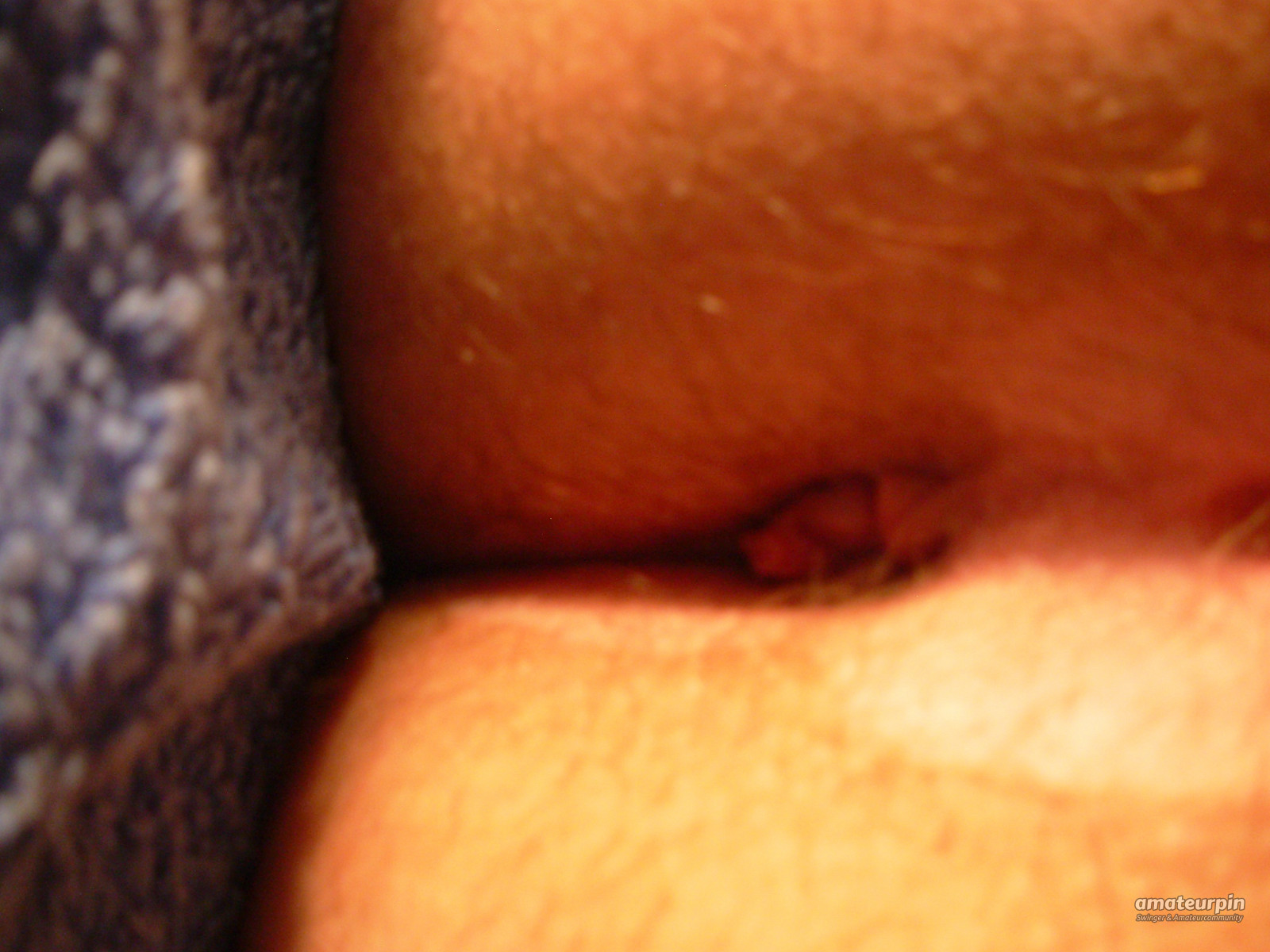 My holes gallery image