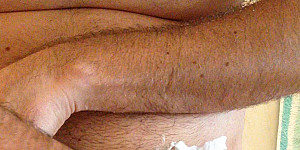 Intimrasur First Thumb Image