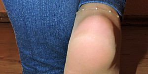Nylonfüsse in Flipflops und Jeans First Thumb Image